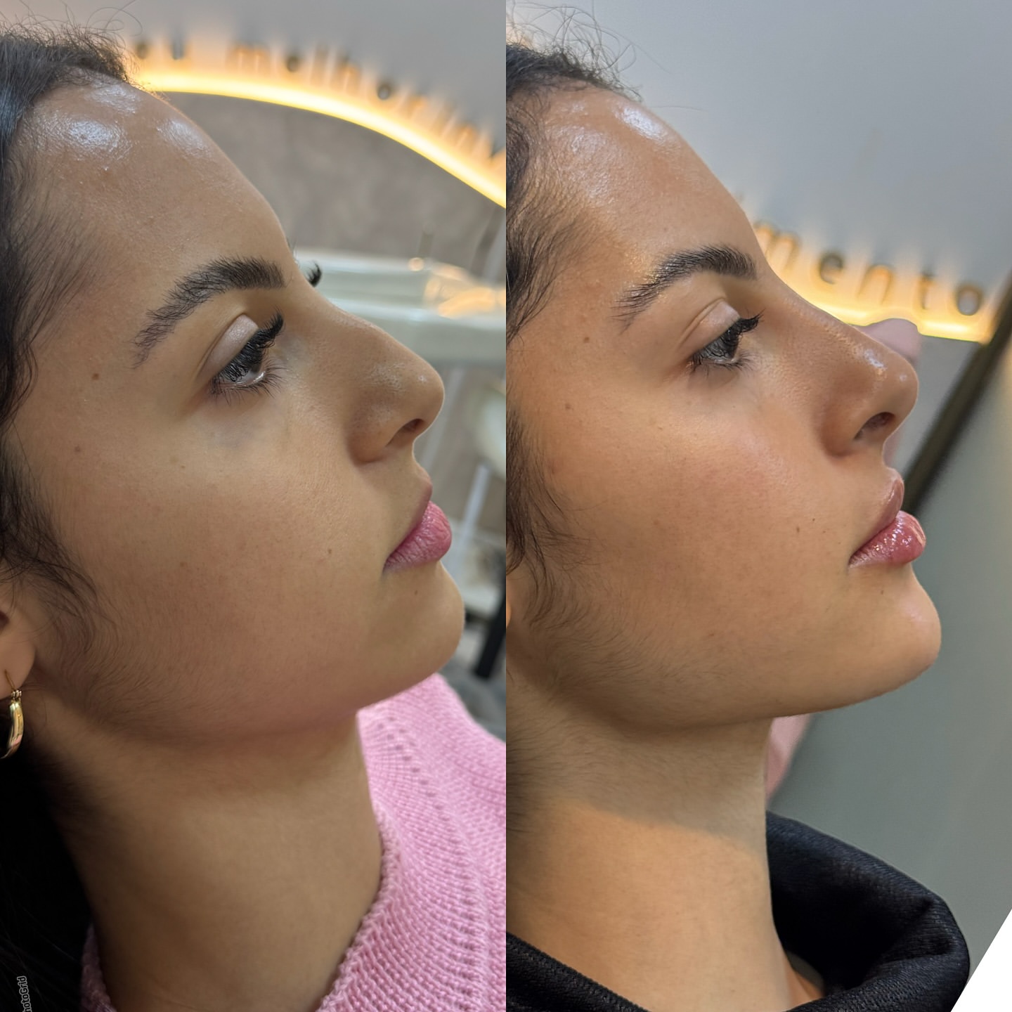 Micropigmentação Labial